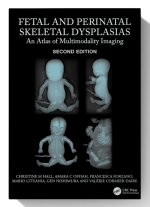 Fetal and Perinatal Skeletal Dysplasias: An Atlas of Multimodality Imaging 2nd Edition