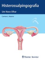 Histerossalpingografia: Um Novo Olhar (Portuguese Edition)