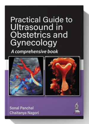 Practical Guide to Ultrasound in Obstetrics and Gynecology: A comprehensive book 1st Edition